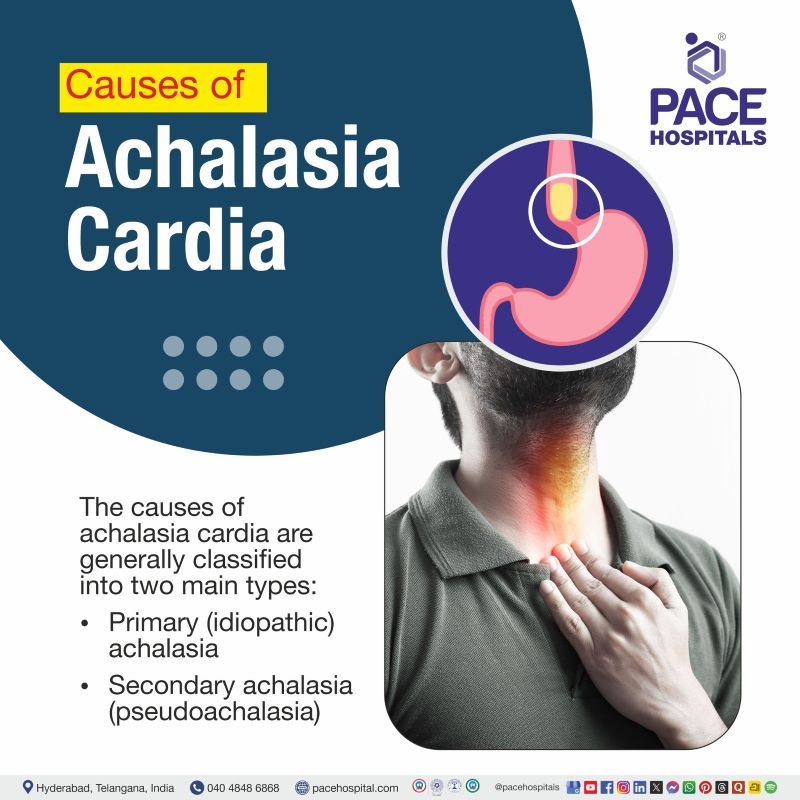 Achalasia Cardia Causes Achalasia Cardia Causes | Causes of Achalasia Cardia