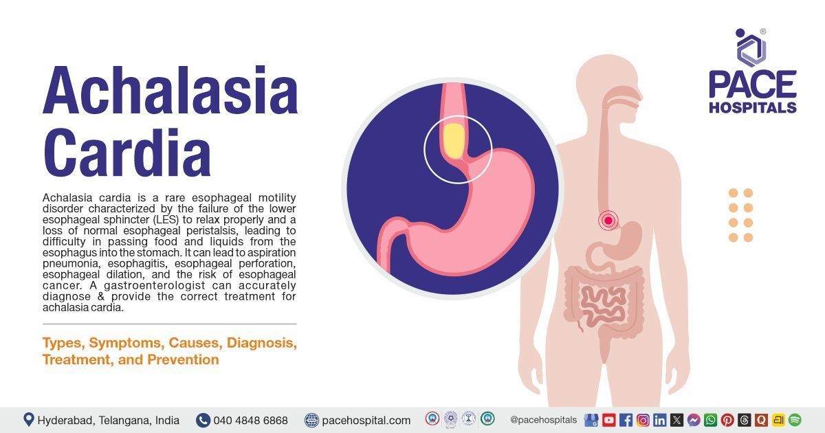 Achalasia Cardia - Causes, Symptoms, Diagnosis & Treatment Options | What is Achalasia Cardia