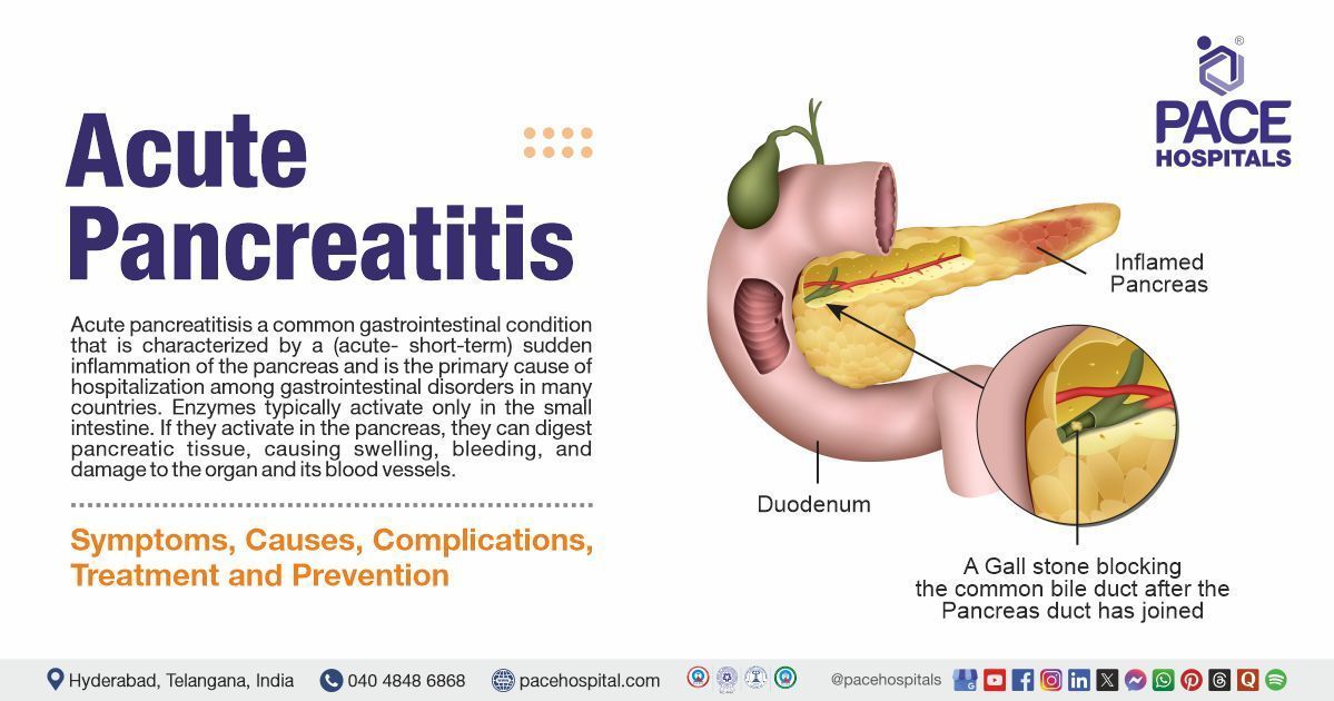 Acute pancreatitis treatment in India | Acute pancreatitis causes & Symptoms | Acute pancreatitis