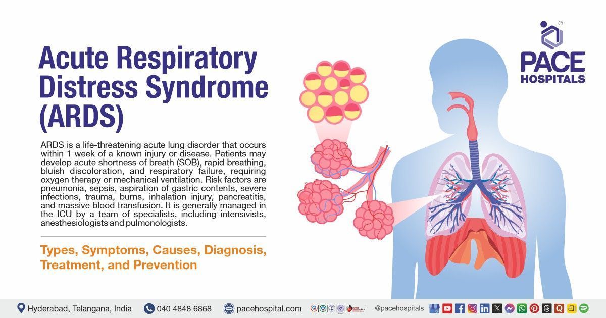Acute Respiratory Distress Syndrome - Types, Symptoms, Causes, Diagnosis & Treatment | What is ARDS