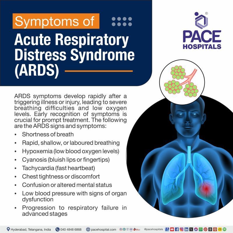 Acute respiratory distress syndrome symptoms | ARDS symptoms | ARDS signs and symptoms