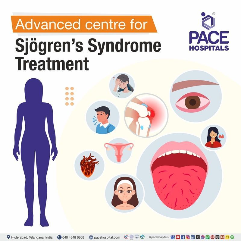 Best Hospital for Sjogren's Syndrome Diagnosis & Treatment in Hyderabad, Telangana, India Best Hospital for Sjogren's Syndrome Treatment in Hyderabad, India | Sjogren's Syndrome Diagnosis in Hyderabad, India