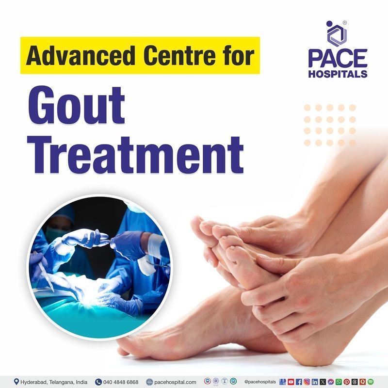 Best Gout Hospital in Hyderabad, India | Best Hospital for Gout Treatment in Hyderabad, India | Centre for Gout Treatment in Hyderabad, India