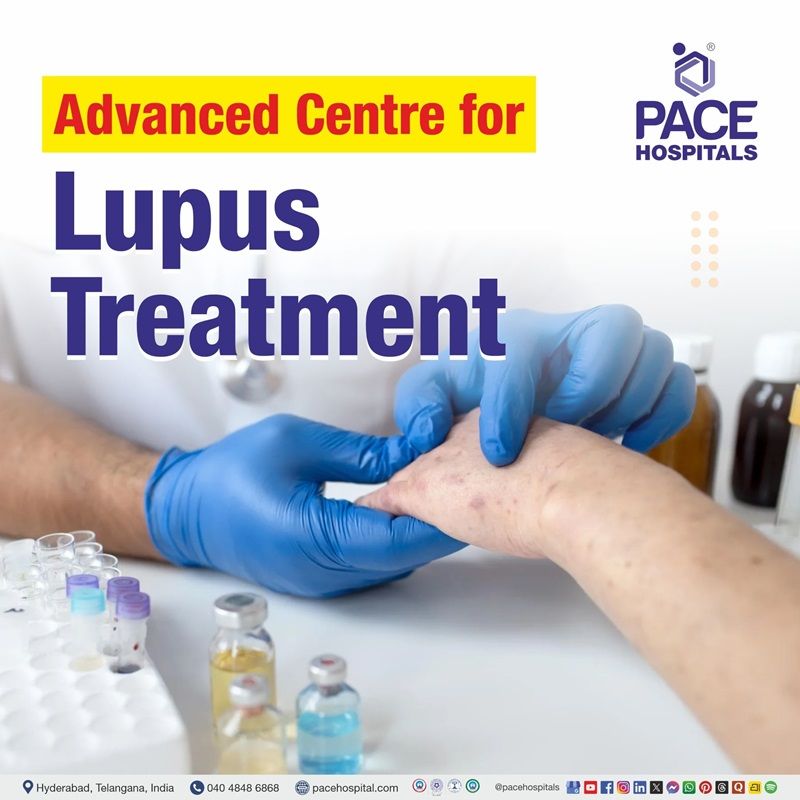 Best Hospital for lupus treatment in Hyderabad | Top hospital for sle treatment in Hyderabad