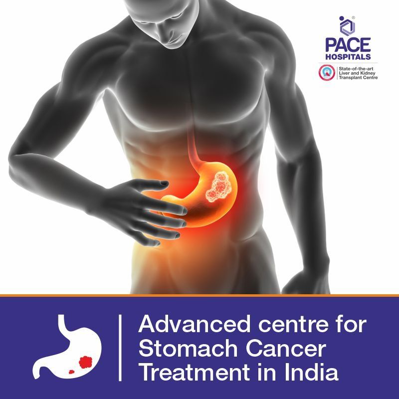 Best Hospital for stomach cancer treatment in Hyderabad