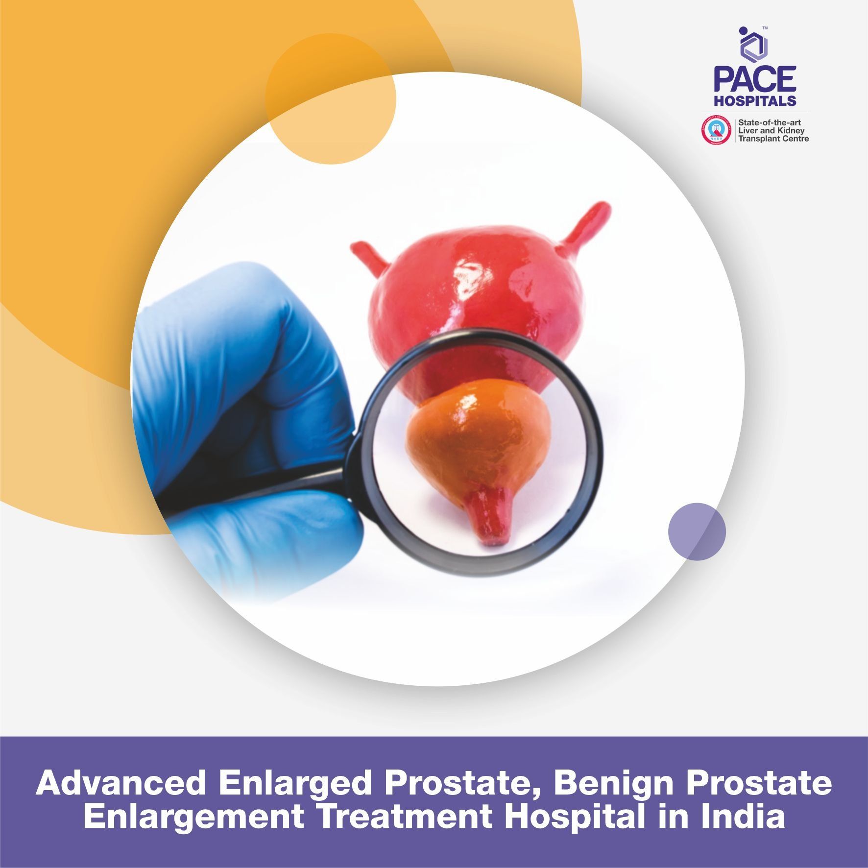 Advanced Enlarged Prostate, Benign Prostate Enlargement Treatment Hospital in India