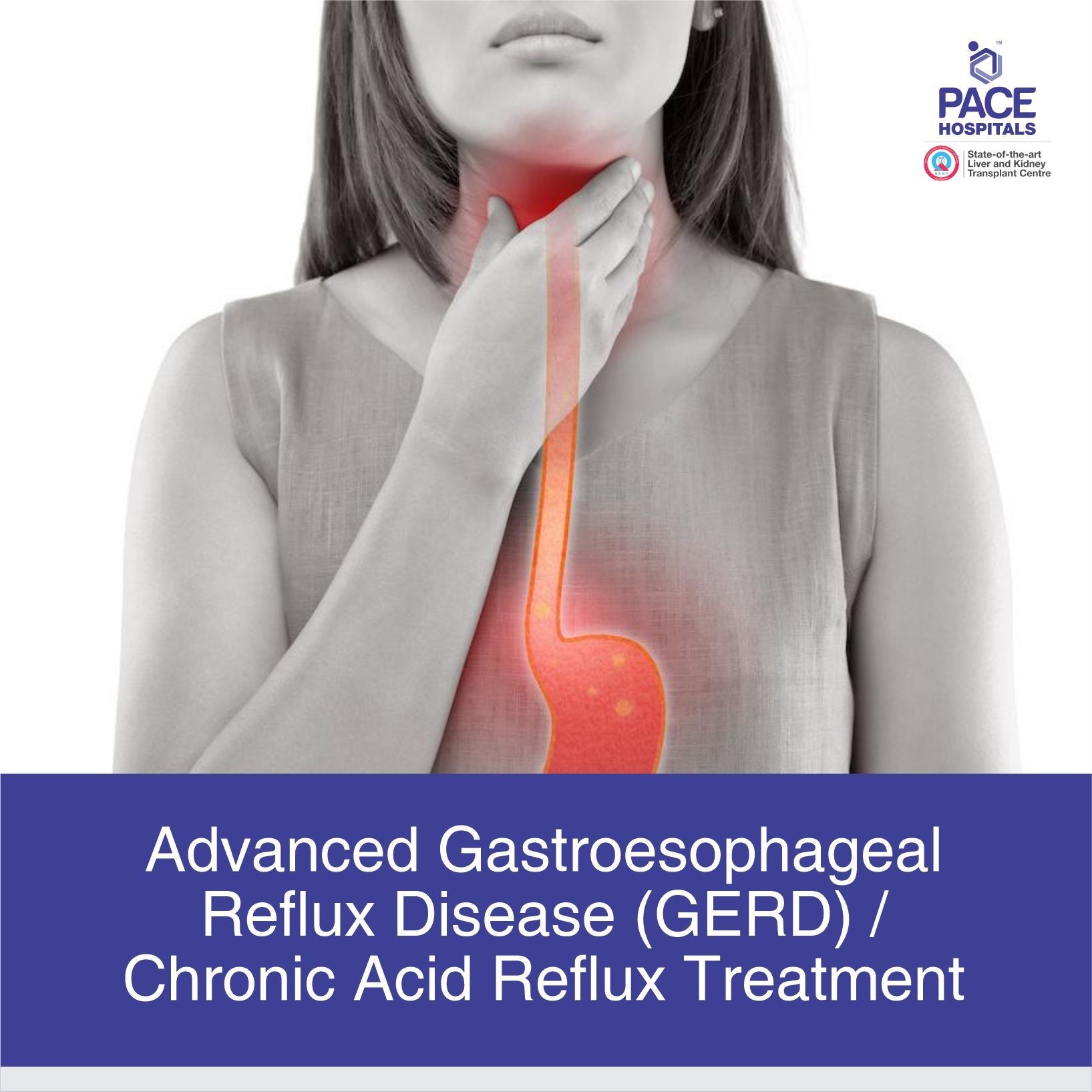 Advanced Gastroesophageal reflux disease (GERD) or Chronic acid reflux Treatment Hospital in Hyderabad