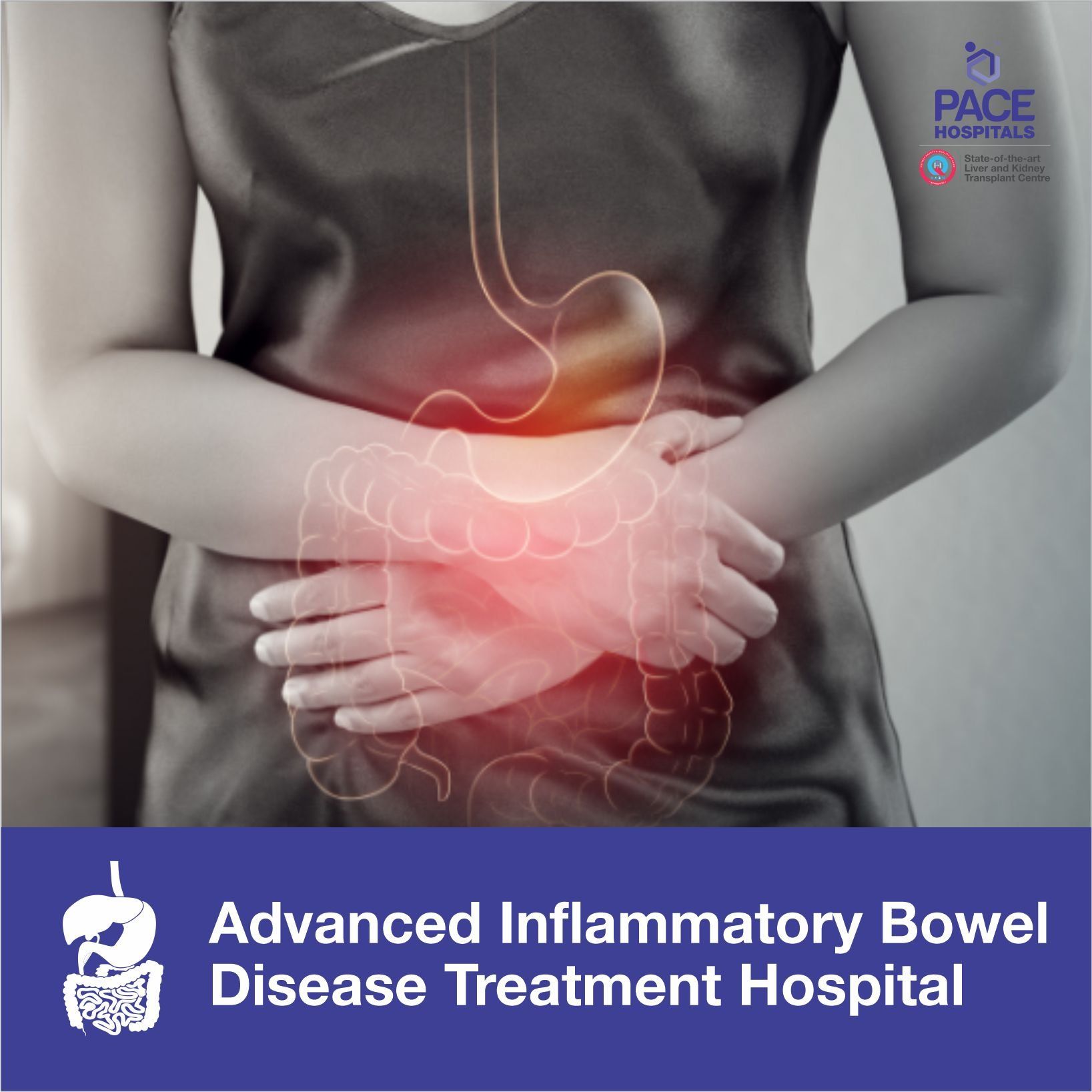 Advanced Inflammatory Bowel Disease (Ulcerative colitis and Crohn's disease) Treatment Hospital in Hyderabad | Pace Hospitals