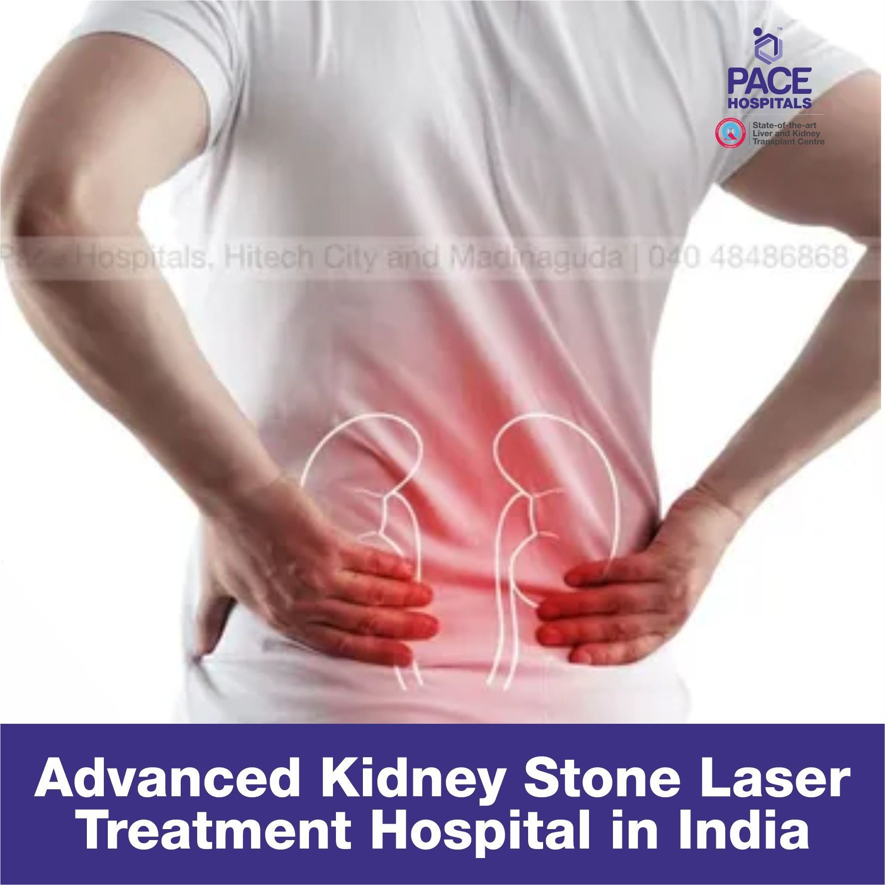 Advanced Kidney Stone Laser Treatment Hospital in India