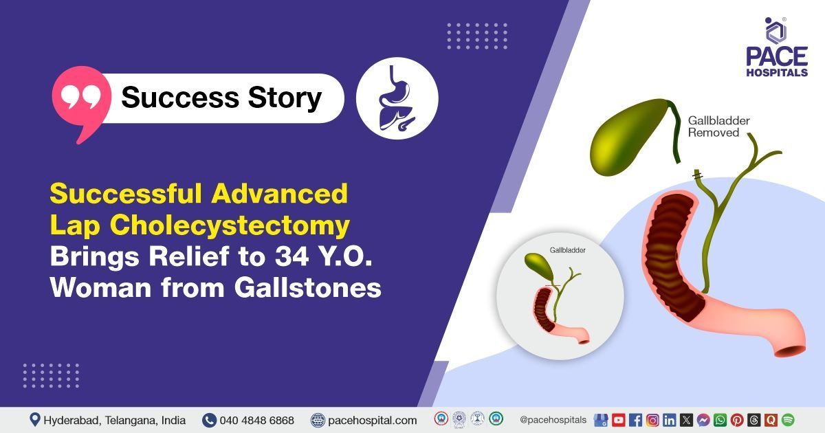 Case study of a 34-Y/O woman suffering from gallstone pain successfully treated at PACE Hospitals