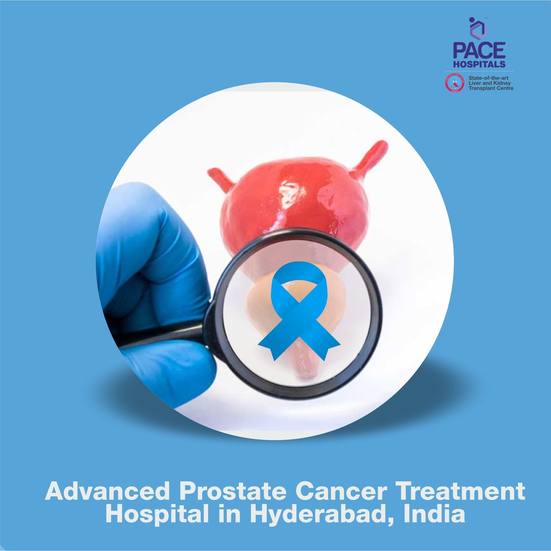 Advanced Prostate Cancer Treatment Hospital in Hyderabad, India - Prostatic Carcinoma