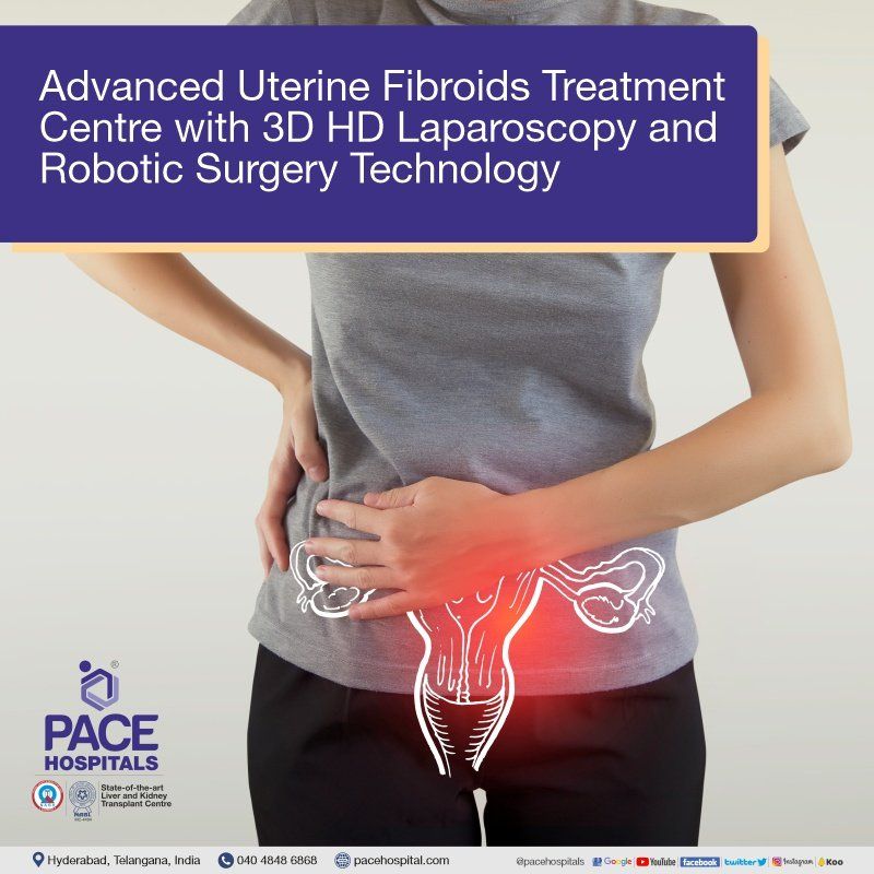 Uterine Fibroid Surgery in Hyderabad | Fibroids Laparoscopic surgery | Robotic Surgery For Uterine Fibroids