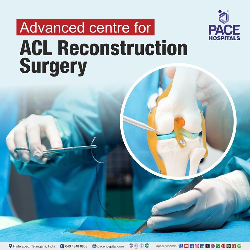 Best Hospital for ACL Reconstruction Surgery in Hyderabad | arthroscopic ACL reconstruction surgery in Hyderabad | Best Hospital for ACL Reconstruction Surgery in Hyderabad, India