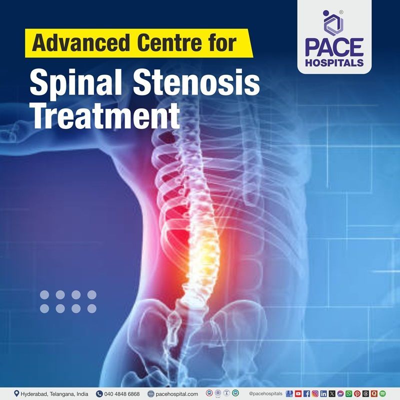 Advanced Centre for Spinal Stenosis Treatment in Hyderabad, Telangana, India Best hospitals for Spinal Stenosis Treatment in Hyderabad, India | Spinal Stenosis Treatment Hospital in Hyderabad, India | Centre for Spinal Stenosis Treatment in Hyderabad, India