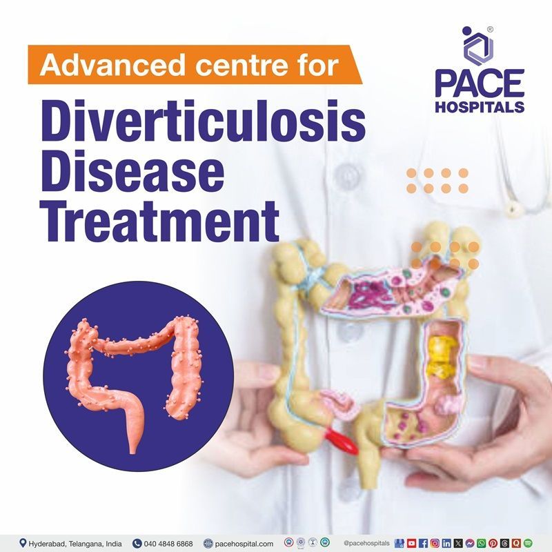 Advanced Centre for Diverticulosis Disease Treatment in Hyderabad, Telangana, India Best hospitals for diverticulosis disease Treatment in Hyderabad, India | diverticulosis disease Treatment Hospital in Hyderabad, India | Centre for diverticulosis Treatment in Hyderabad, India