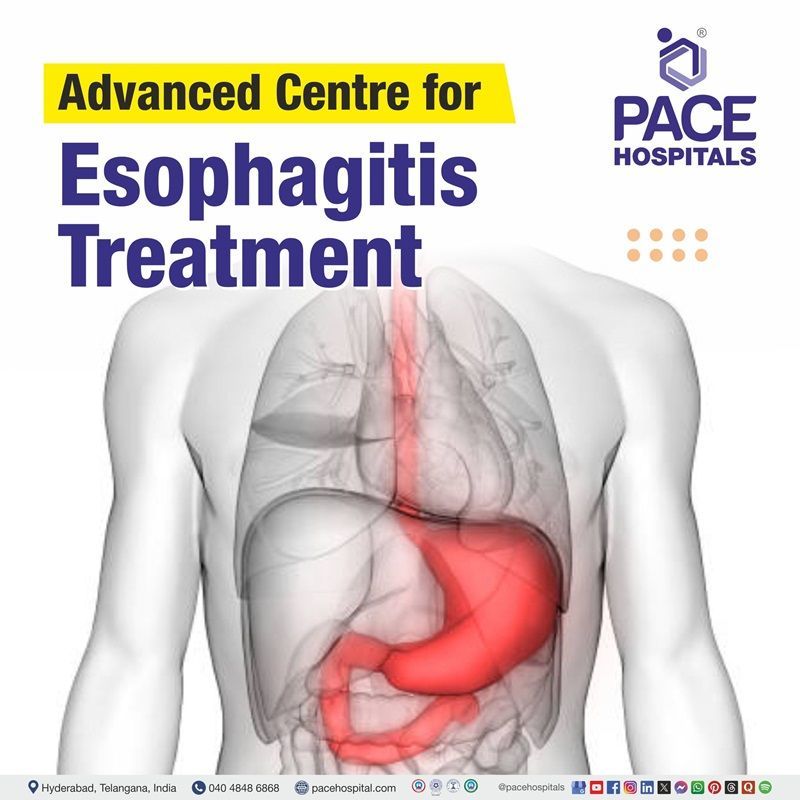 Best hospitals for Esophagitis Treatment in Hyderabad, India | Esophagitis Treatment Hospital in Hyderabad, India | Centre for Osteoarthritis Treatment in Hyderabad, India