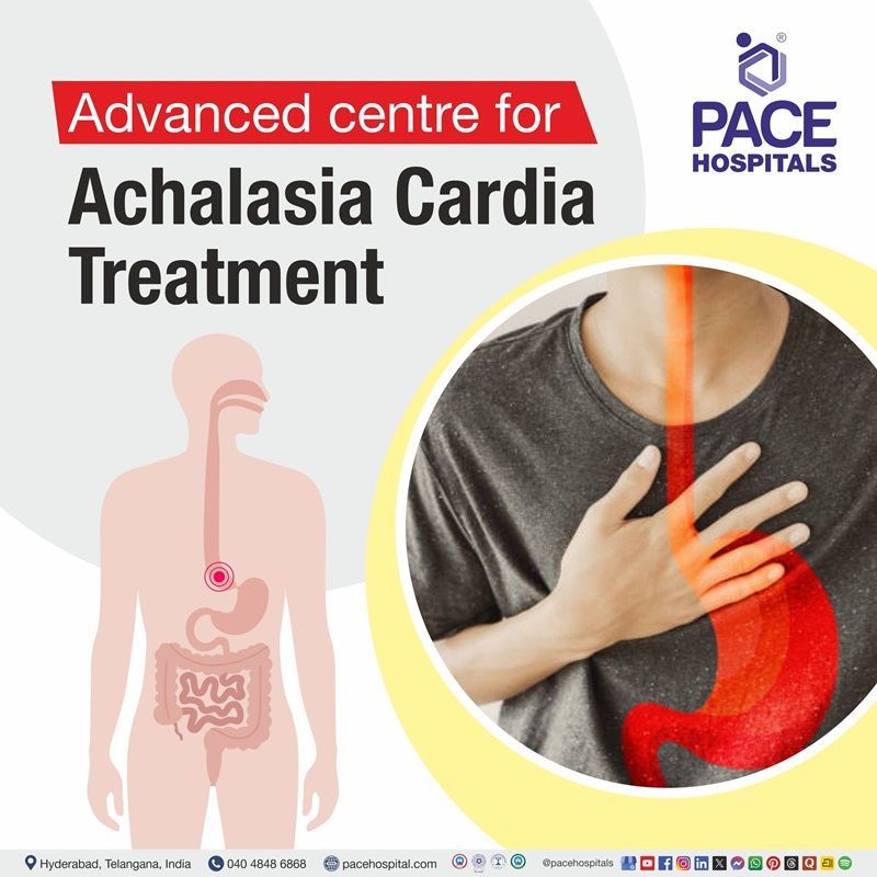 Best Hospital for achalasia cardia Surgery in Hyderabad, India | Achalasia cardia diagnosis and Treatment in Hyderabad, India