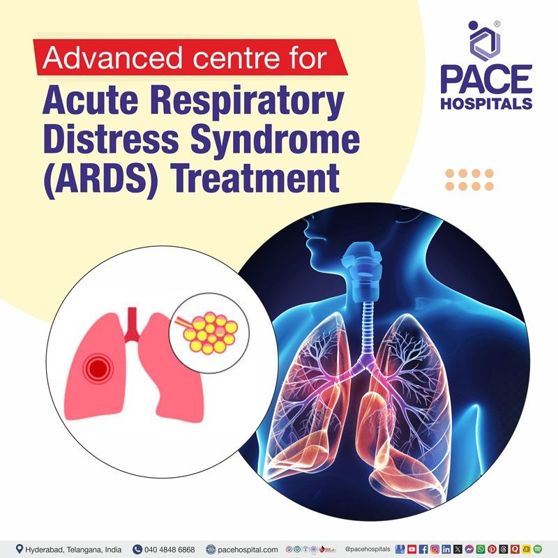 Best Hospital for ARDS Treatment in Hyderabad | Acute Respiratory Distress Syndrome Treatment in Hyderabad, India