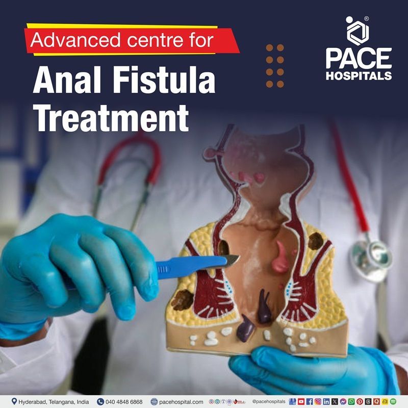 Anal fistula treatment hospital in Hyderabad | Best hospital for fistula in ano treatment in Hyderabad, India