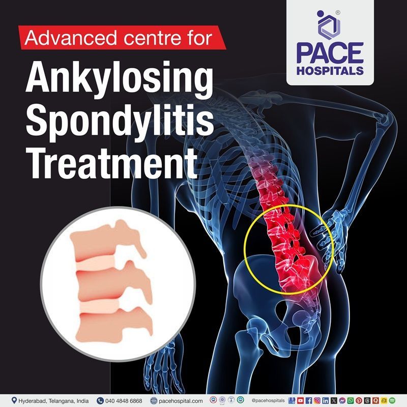 best hospital for ankylosing spondylitis in Hyderabad, India | ankylosing spondylitis diagnosis and Treatment in Hyderabad, India