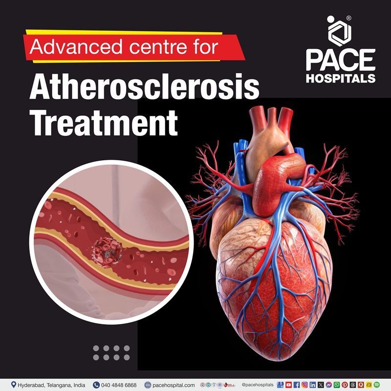atherosclerosis treatment hospital in Hyderabad | top hospital for atherosclerosis treatment in Hyderabad, India