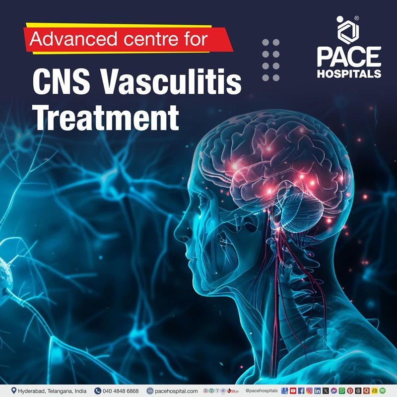 cns vasculitis treatment hospital in Hyderabad | best hospital for central nervous system vasculitis treatment in Hyderabad, India