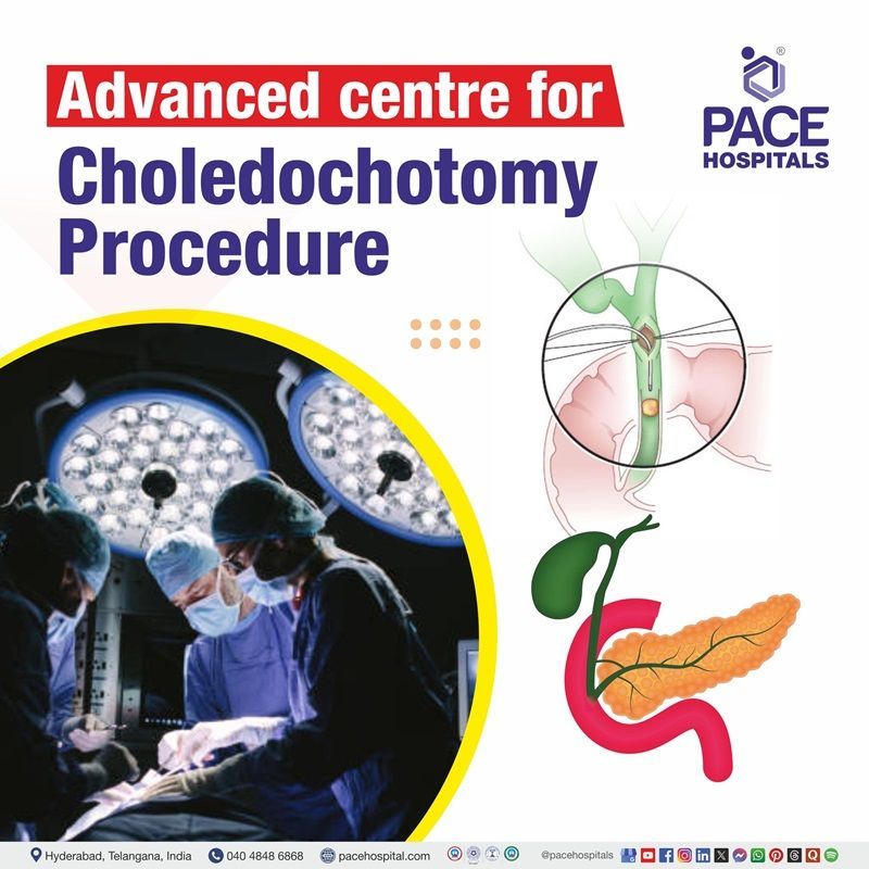Advanced Centre for Choledochotomy Procedure in Hyderabad, India Best hospital for choledochotomy procedure in Hyderabad | Best choledochotomy surgery Hospital in Hyderabad | Best choledochotomy procedure hospital in Hyderabad, India