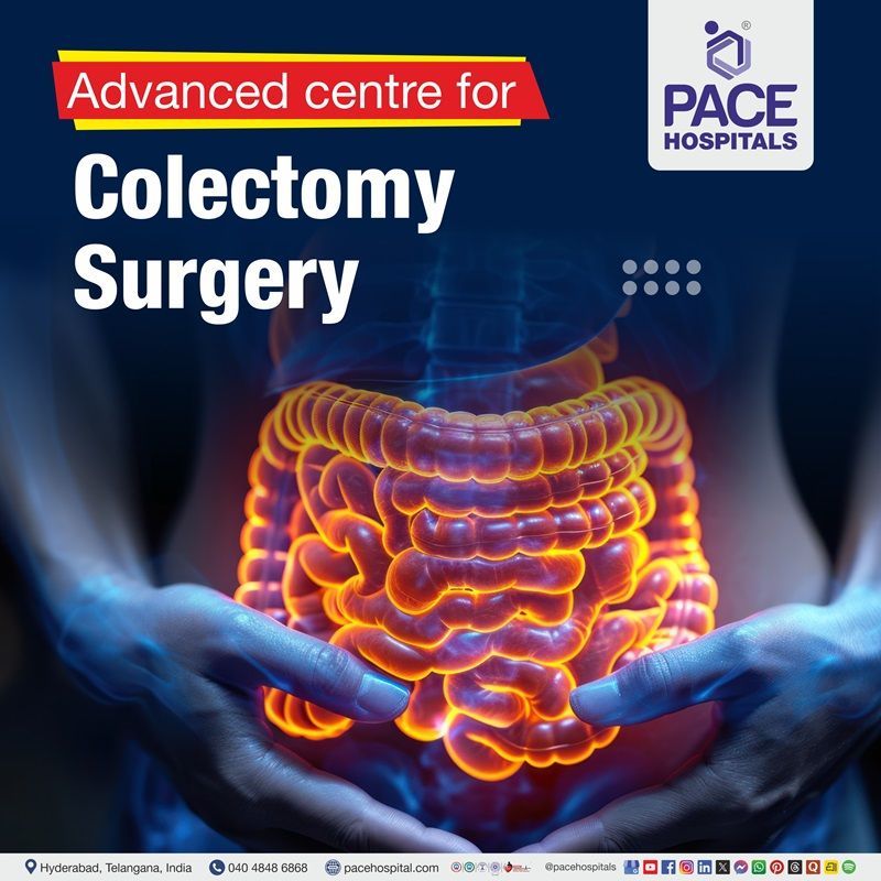 Advanced Centre for Colectomy Surgery in Hyderabad, India Hospital for Colectomy Procedure in Hyderabad, India | Colectomy surgery Hospital in Hyderabad, India