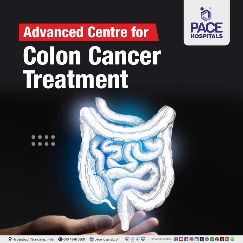 Best Colon Cancer Hospital in Hyderabad, India | Advanced Colon Cancer Treatment