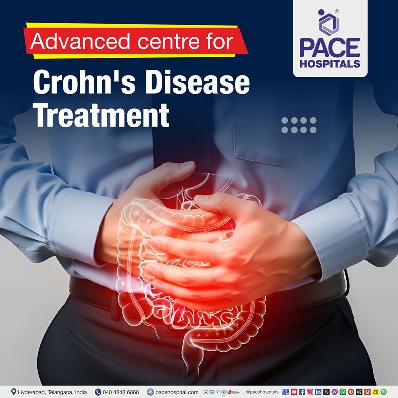 Management of crohn's disease in Hyderabad | Crohn’s  Disease diagnosis near me | Crohn’s  Disease treatment in Hyderabad