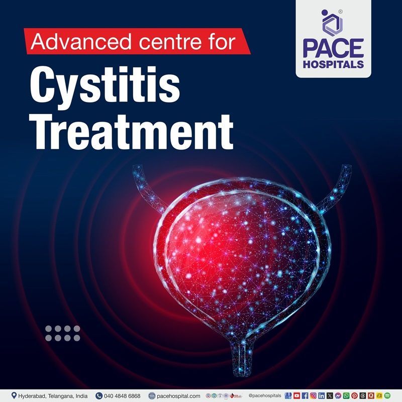 Advanced Centre for Cystitis Treatment in Hyderabad, Telangana, India Best Hospital for cystitis Treatment in Hyderabad | Bladder infection Treatment Hospital in Hyderabad, India | Bladder infection Treatment in Hyderabad, India