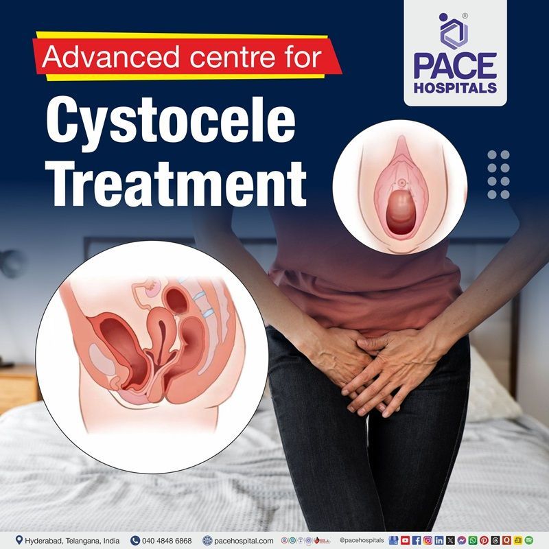 Best hospital for cystocele repair | prolapsed bladder treatment in Hyderabad