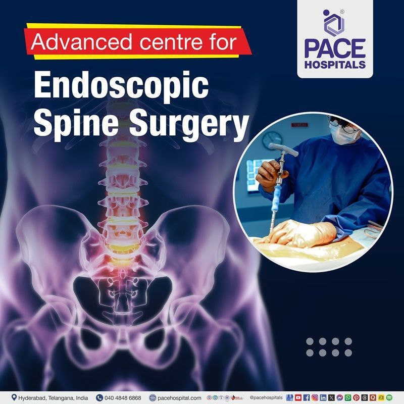Best Hospital for endoscopic spine surgery in Hyderabad | endoscopic spine surgery  in Hyderabad, India