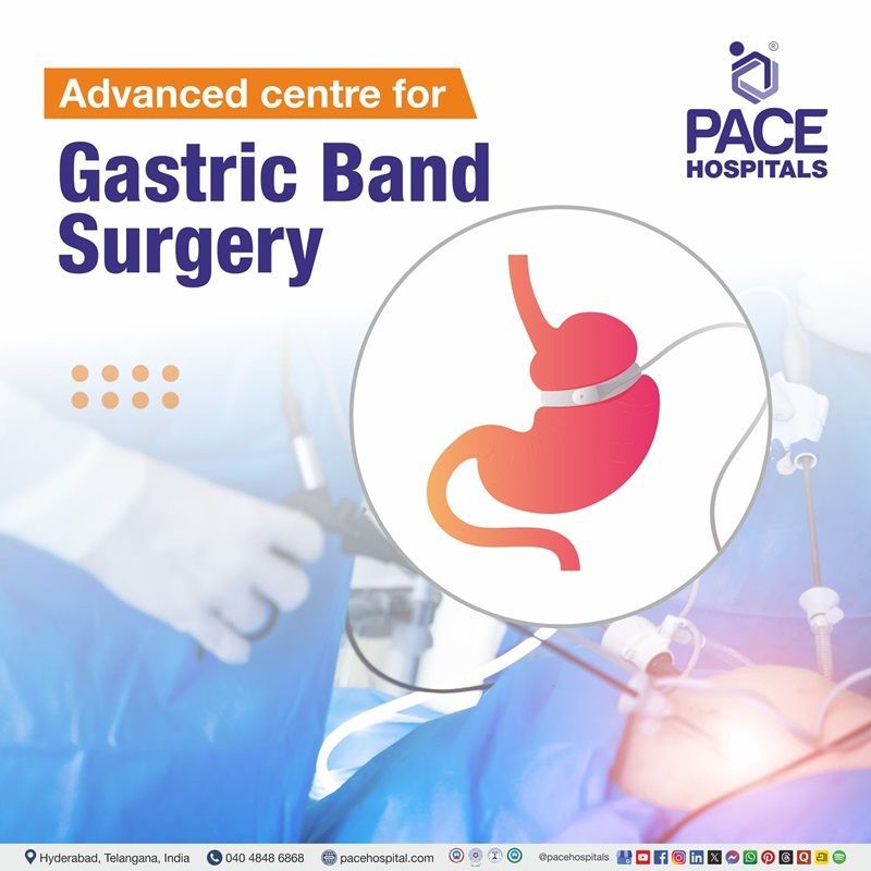 Best Hospital for Gastric Band Procedure in Hyderabad | Leading center for Gastric band surgery in Telangana, India
