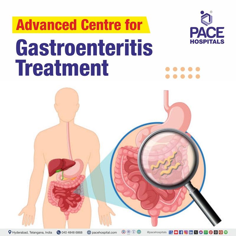 Advanced Centre for Gastroenteritis Treatment in Hyderabad, Telangana, India Best gastroenteritis hospital in Hyderabad, India | Best Hospital for Gastroenteritis Treatment in Hyderabad, India | Centre for Gastroenteritis Treatment in Hyderabad, India