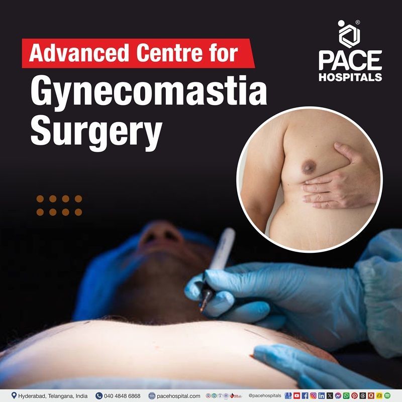 Best Hospital for gynecomastia surgery in Hyderabad, India | male breast reduction surgery in Hyderabad, India