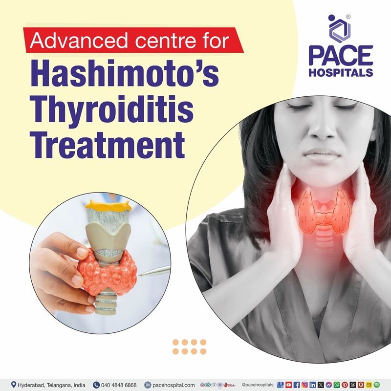 Best Hospital for hashimoto's thyroiditis Disease Treatment in Hyderabad | Hashimot treatment Hospital in Hyderabad, India