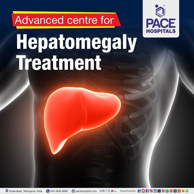 Best Hospital for enlarged liver treatment in Hyderabad | hepatomegaly treatment Hospital in Hyderabad, India