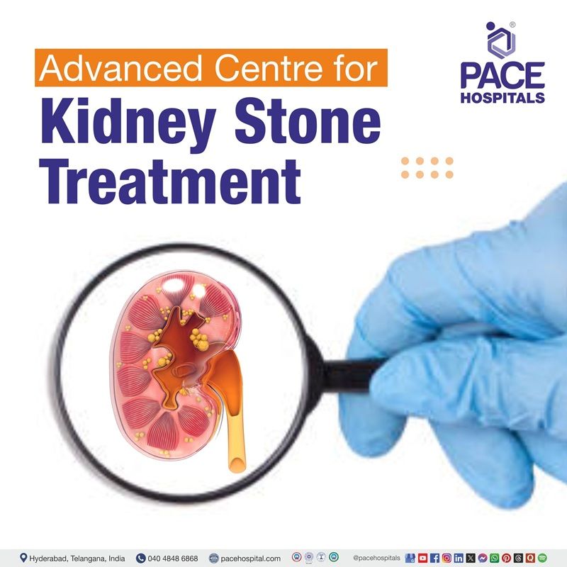 Advanced Centre for Kidney Stones Treatment in Hyderabad, Telangana, India Best kidney stones hospital in Hyderabad, India | kidney stone surgery hospital in Hyderabad, India