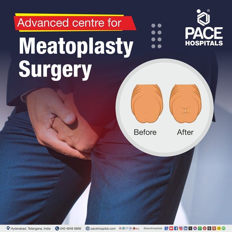 Meatoplasty Surgery in Hyderabad India | Meatoplasty Surgery near me | Best Hospital for Meatoplasty Surgery