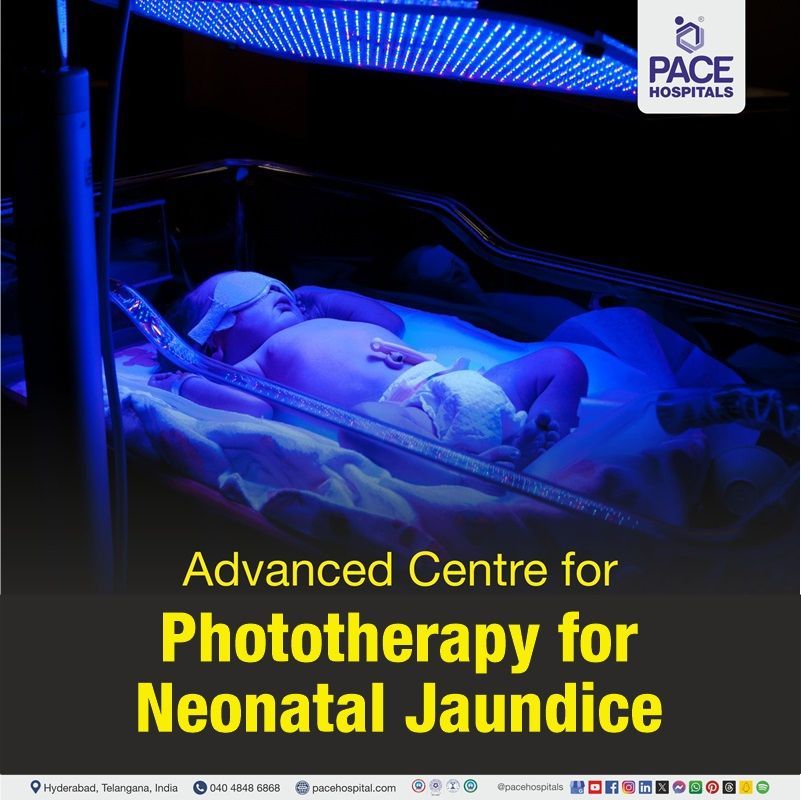 best hospital for phototherapy treatment for jaundice in newborn in Hyderabad | phototherapy for neonatal jaundice in Hyderabad | phototherapy near me for neonatal jaundice