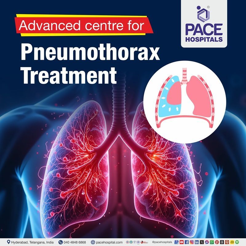 Advanced Centre for Pneumothorax Treatment in Hyderabad, India Best Hospital for Pneumothorax Treatment in Hyderabad | Advanced Pneumothorax Management Hospital in Hyderabad, India