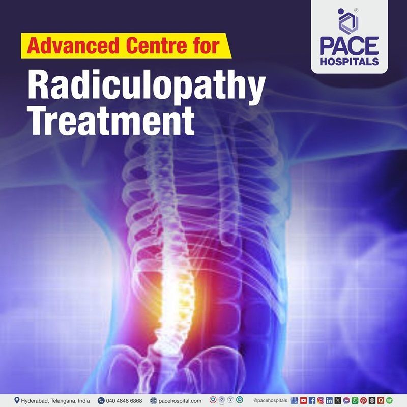 Advanced Centre for Radiculopathy Treatment in Hyderabad, Telangana, India Best Hospital for radiculopathy in Hyderabad, India | radiculopathy treatment Hospital in Hyderabad, India | Centre for radiculopathy treatment in Hyderabad, India