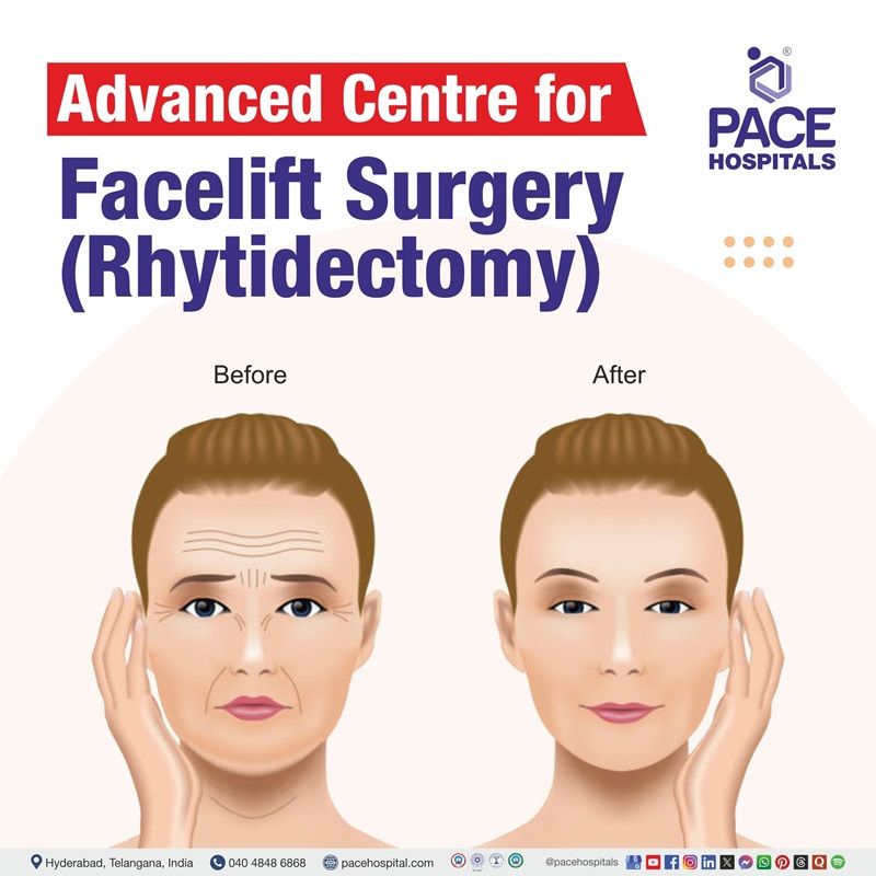 Best hospital for Rhytidectomy in Hyderabad | Best Facelift Surgery Hospital in Hyderabad | Best Rhytidectomy procedure hospital in Hyderabad, India