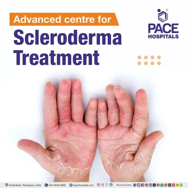 best hospital for scleroderma in Hyderabad, India | scleroderma diagnosis and Treatment in Hyderabad, India