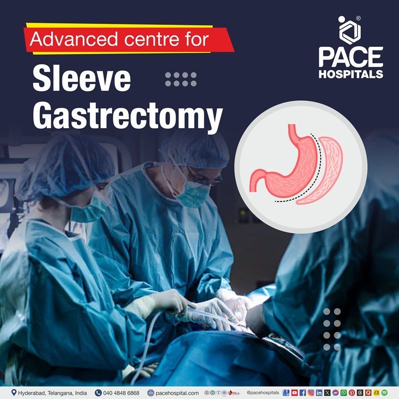 Best Hospital for sleeve gastrectomy in Hyderabad | Advanced center for laparoscopic sleeve gastrectomy in Hyderabad, India