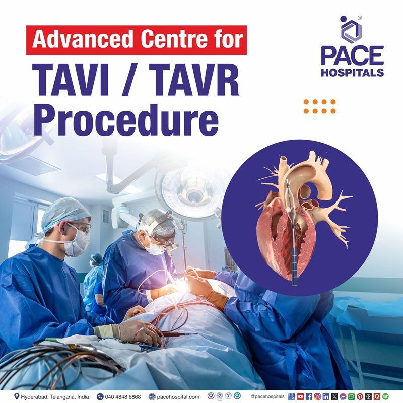 Best hospital for TAVI/TAVR procedure in Hyderabad | TAVI/TAVR procedure cost in Hyderabad | TAVI/TAVR procedure hospital in Hyderabad, India