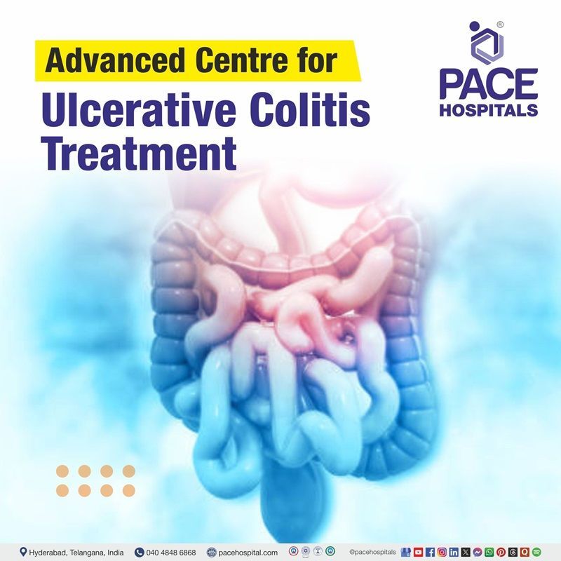 Best hospitals for Ulcerative Colitis Treatment in Hyderabad, India | Ulcerative Colitis Treatment Hospital in Hyderabad, India | Centre for Ulcerative Colitis Treatment in Hyderabad, India