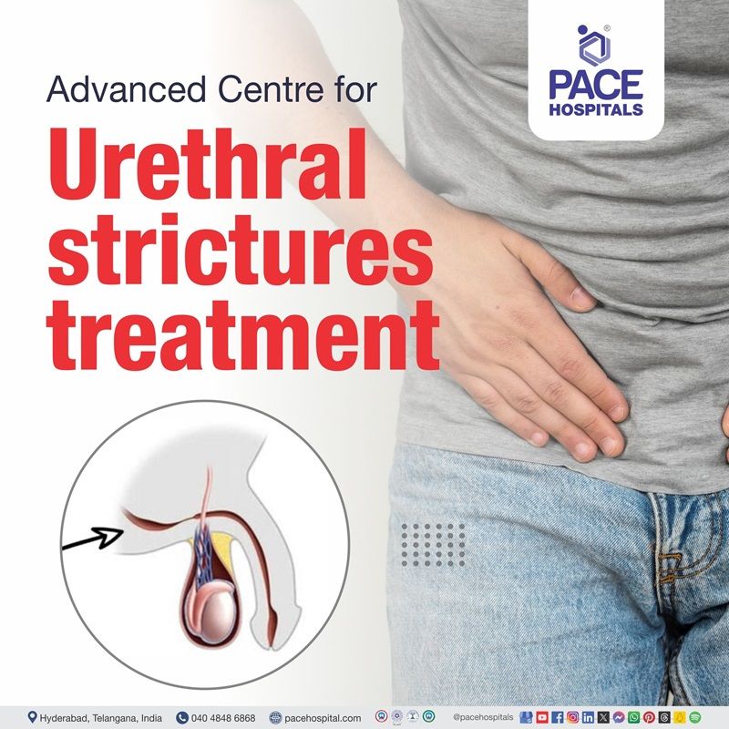 best hospital urethral stricture treatment in Hyderabad | best treatment for Urethral Stricture in Hyderabad | urethral stricture surgery hospital in Hyderabad | urethral stricture treatment near me