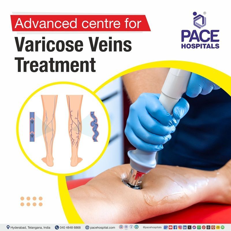 Best Hospital for varicose veins Treatment in Hyderabad | varicose veins hospital in Hyderabad, India
